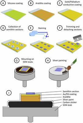 Neuroanatomy from Mesoscopic to Nanoscopic Scales: An Improved Method for the Observation of Semithin Sections by High-Resolution Scanning Electron Microscopy